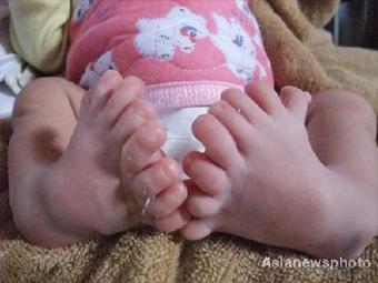 16-toed-baby
